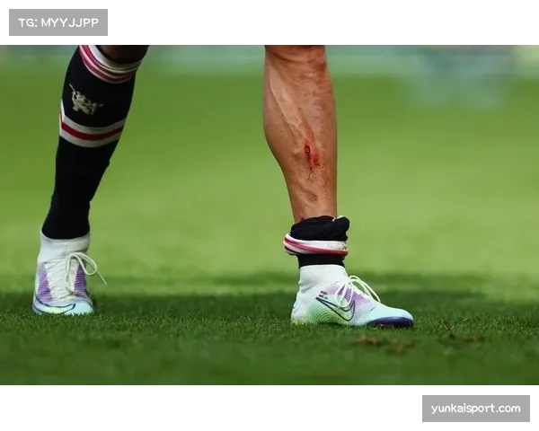 利马小腿旧伤再次复发 曼联后防伤病潮达临界点